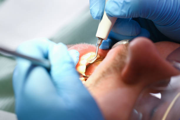 Best Urgent Care for Lost Fillings or Crowns in Bastrop, LA